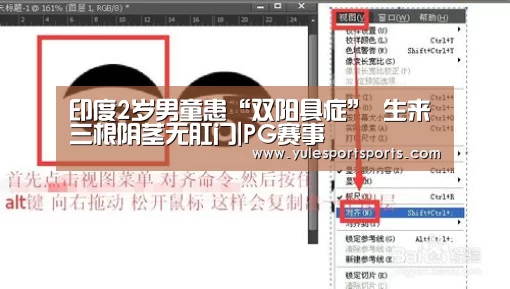 印度2岁男童患“双阳具症” 生来三根阴茎无肛门|PG赛事(图1) PG首页